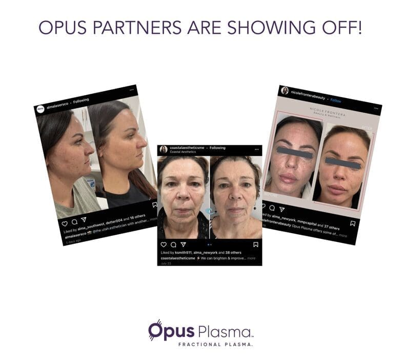 A collage of photos with the words opus partners are showing off